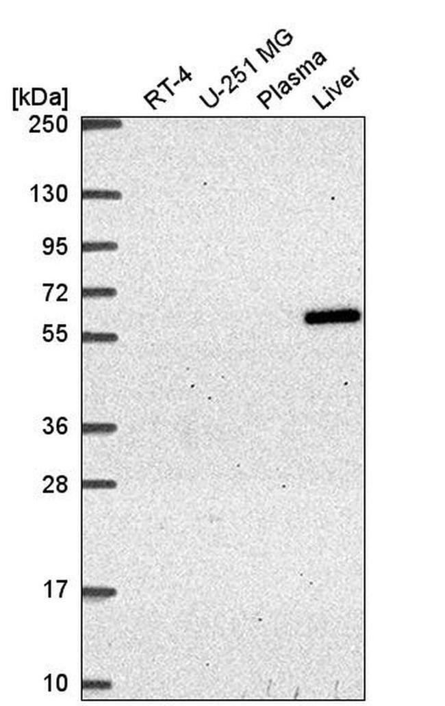 TIN2 Antibody in Western Blot (WB)
