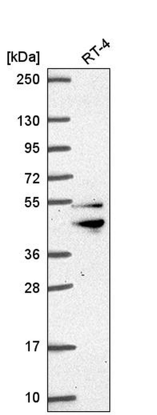 ZFYVE27 Antibody in Western Blot (WB)