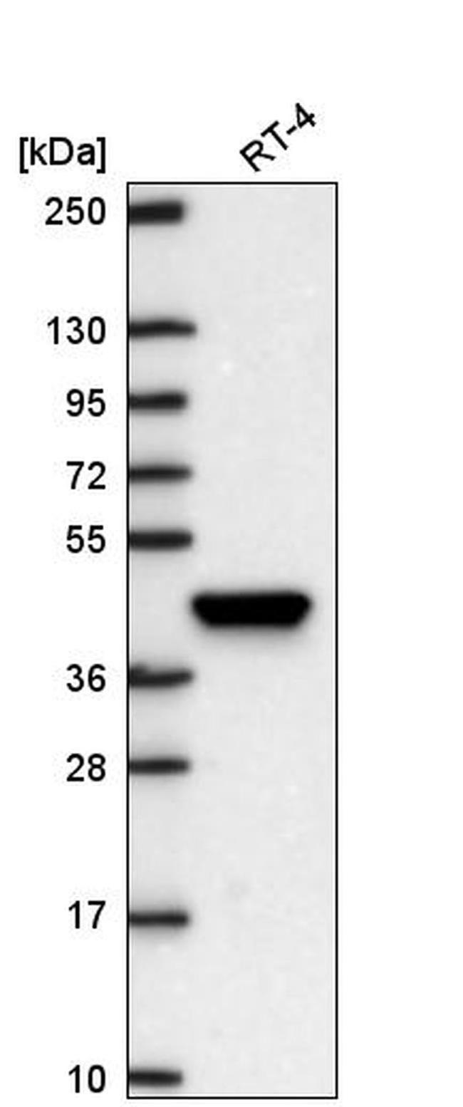 LHX8 Antibody in Western Blot (WB)