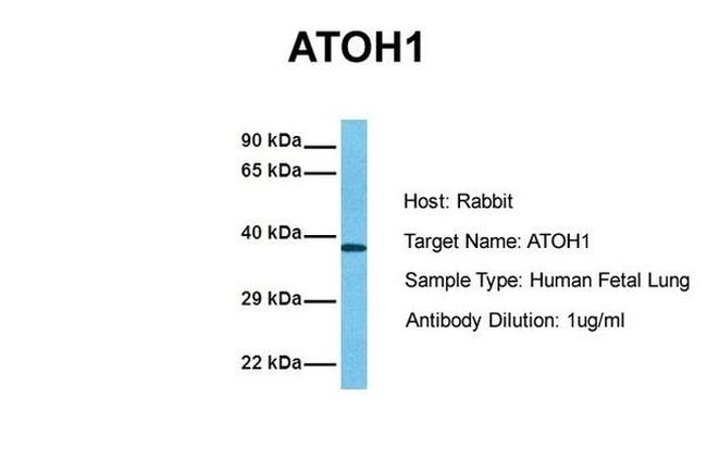 ATOH1 Antibody in Western Blot (WB)