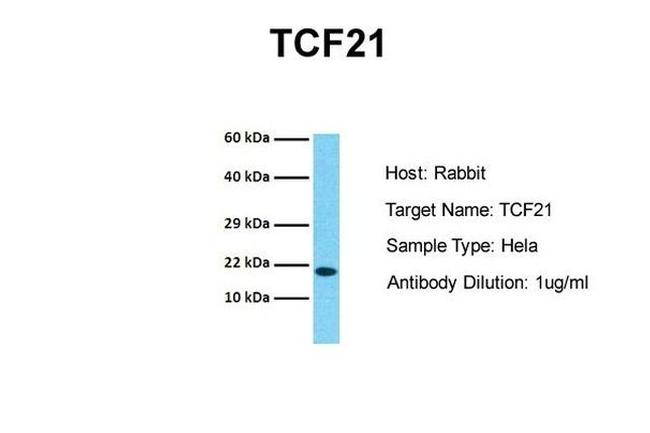 TCF21 Antibody in Western Blot (WB)