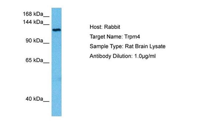 TRPM4 Antibody in Western Blot (WB)