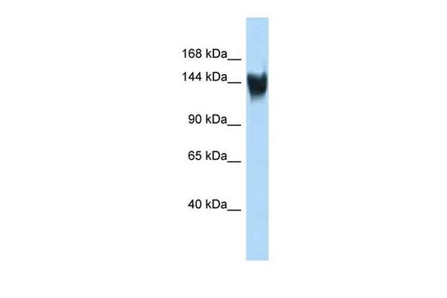 Gm6185 Antibody in Western Blot (WB)
