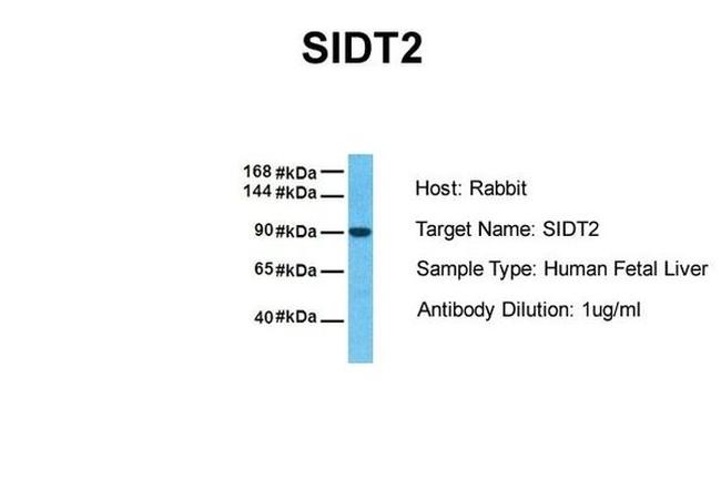 SIDT2 Antibody in Western Blot (WB)