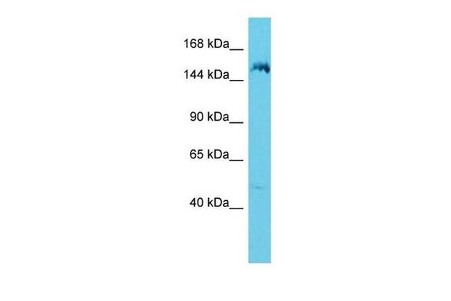 ANKRD36B Antibody in Western Blot (WB)