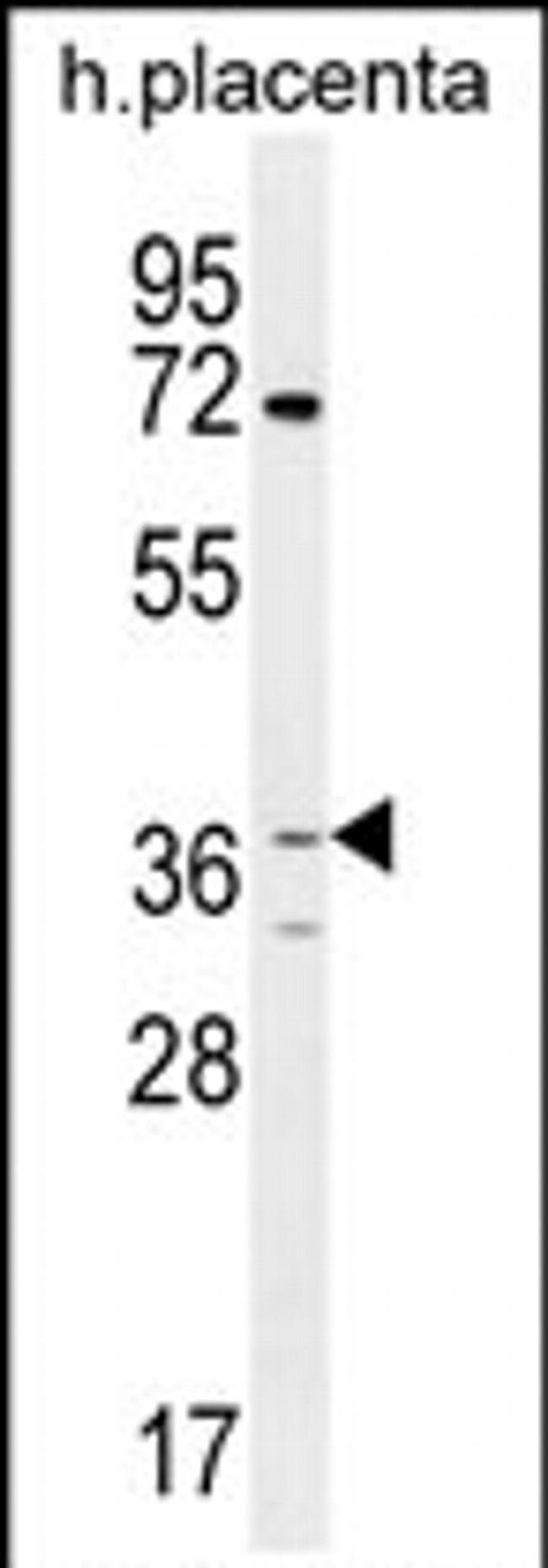 OR2AT4 Antibody in Western Blot (WB)