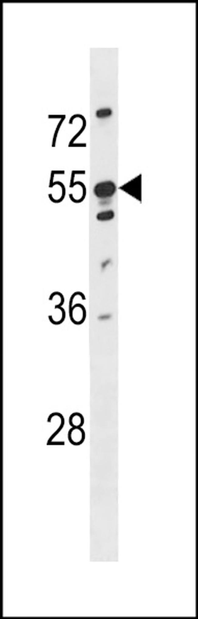 KRT86 Antibody in Western Blot (WB)