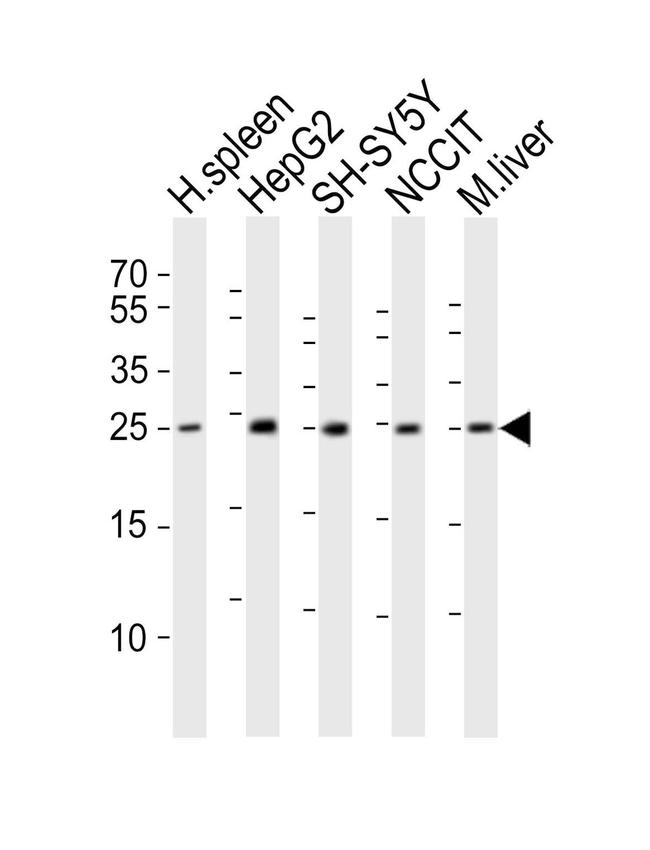 MIXL1 Antibody in Western Blot (WB)