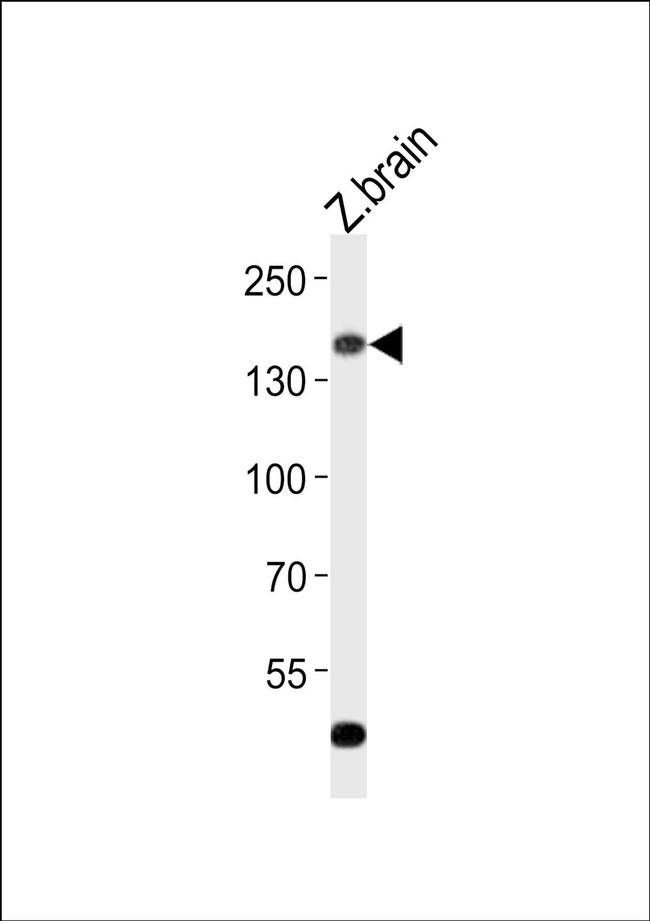 GPR126 Antibody in Western Blot (WB)
