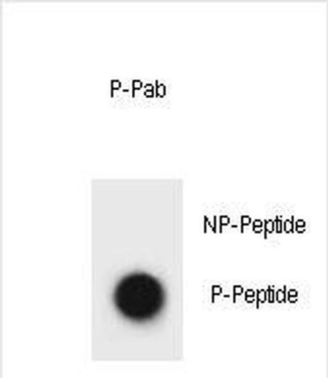 Phospho-Cyclin B3 (Thr258) Antibody in Dot Blot (DB)