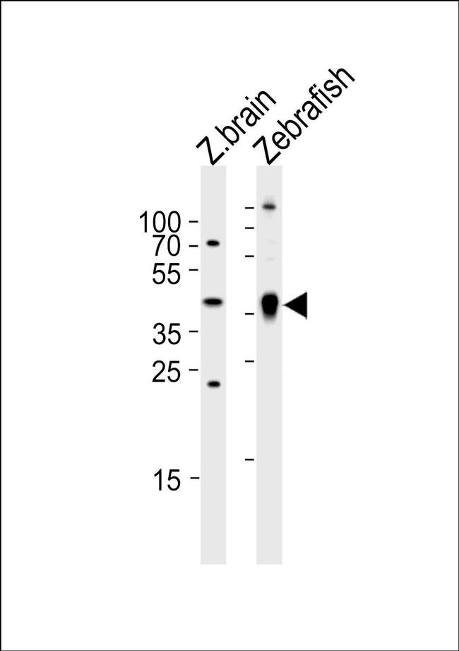 Adenosine Deaminase Antibody in Western Blot (WB)
