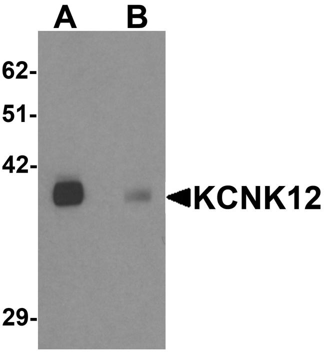 KCNK12 Antibody in Western Blot (WB)