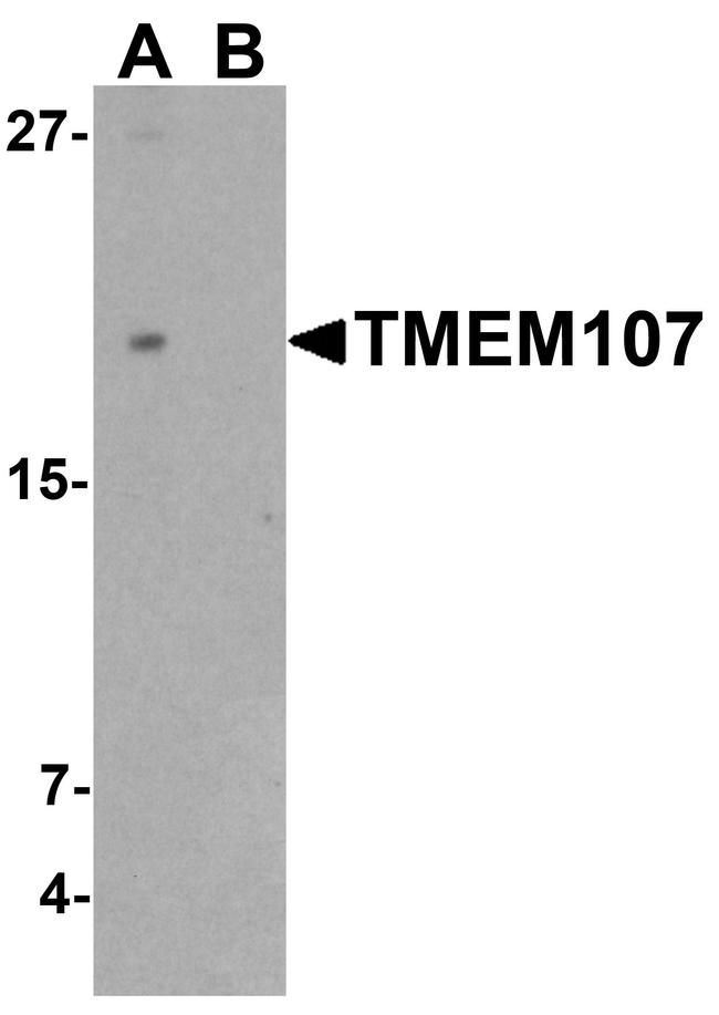 TMEM107 Antibody in Western Blot (WB)