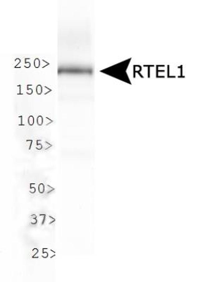 RTEL1 Antibody in Western Blot (WB)