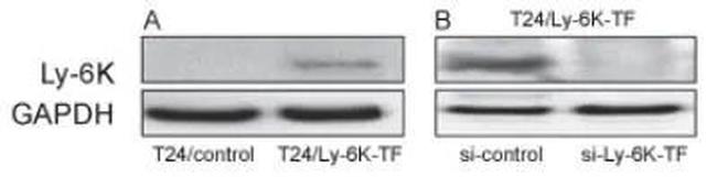 LY6K Antibody in Western Blot (WB)