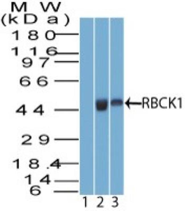 RBCK1 Antibody in Western Blot (WB)