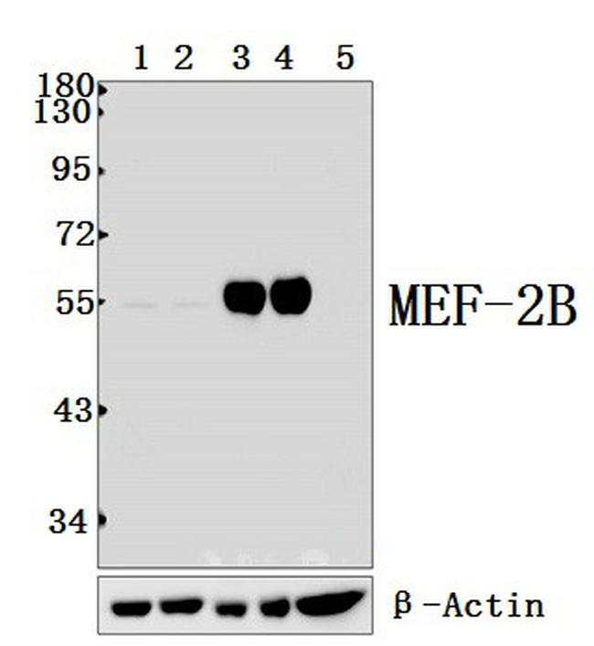 MEF2B Antibody in Western Blot (WB)