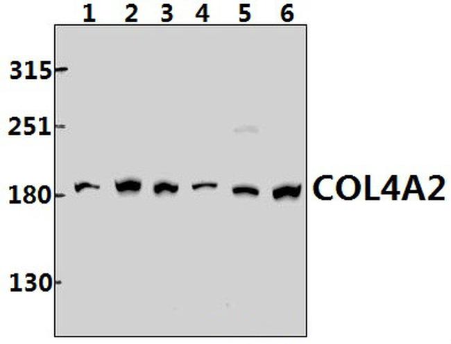COL4A2 Antibody in Western Blot (WB)