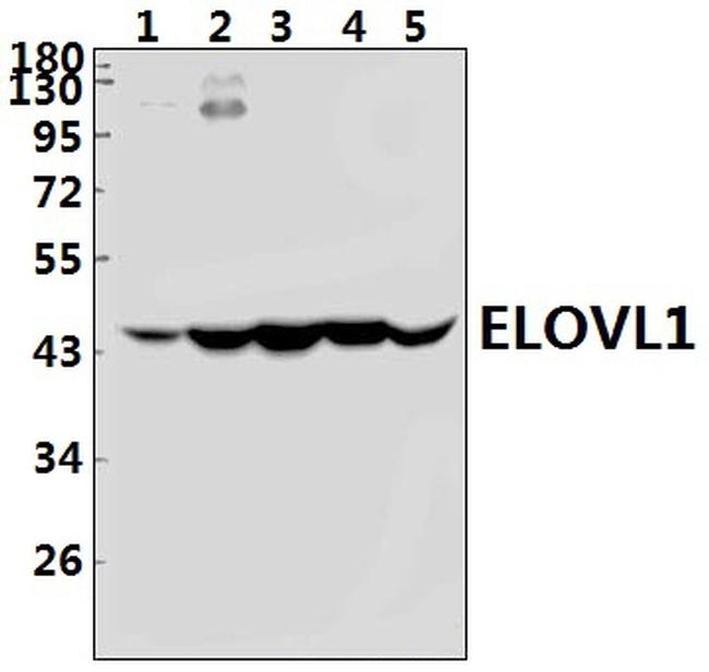 ELOVL1 Antibody in Western Blot (WB)