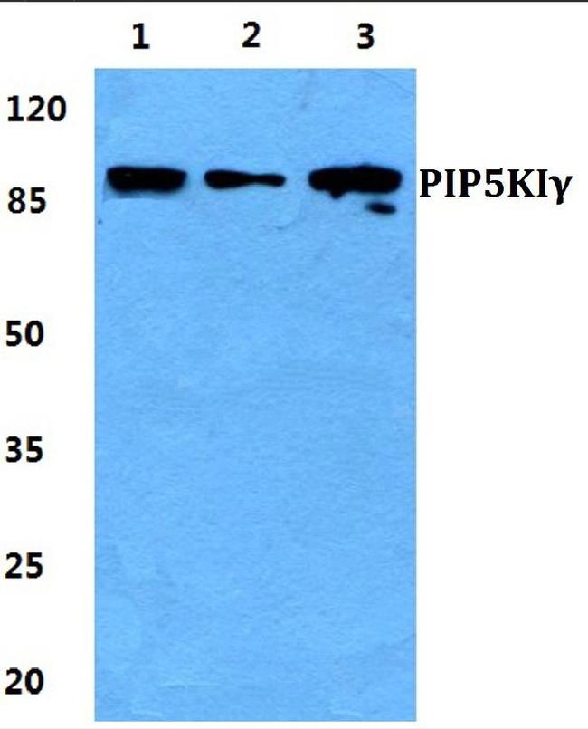 PIP5K1C Antibody in Western Blot (WB)