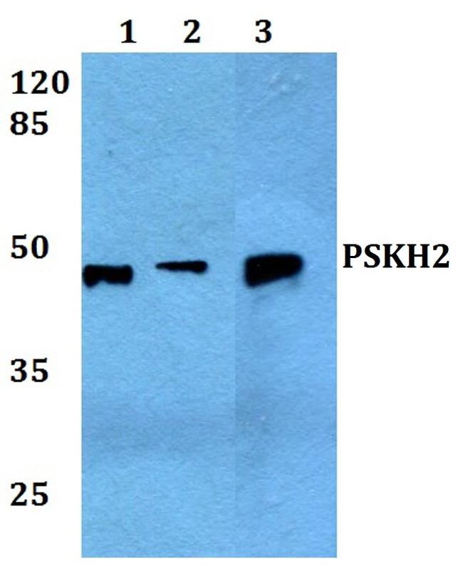 PSKH2 Antibody in Western Blot (WB)