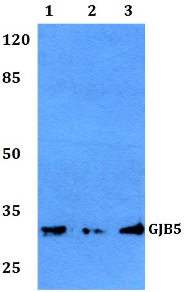 Connexin 31.1 Antibody in Western Blot (WB)