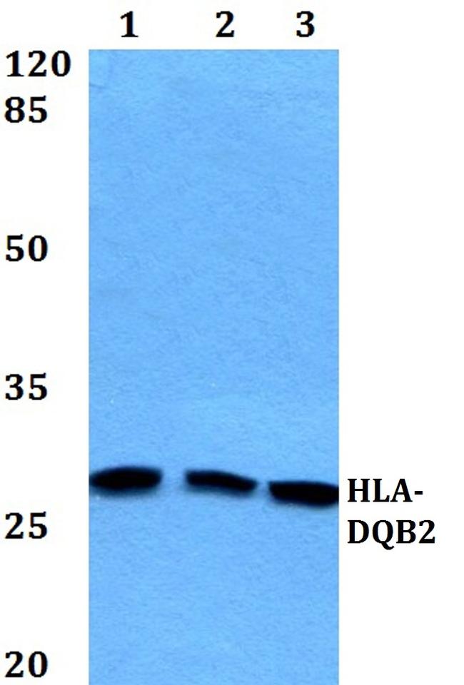 HLA-DQB2 Antibody in Western Blot (WB)