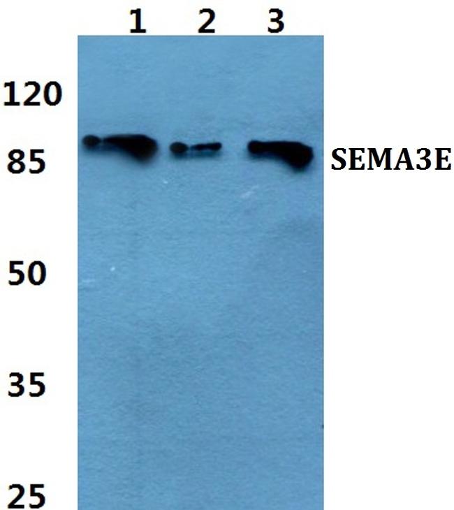 SEMA3E Antibody in Western Blot (WB)