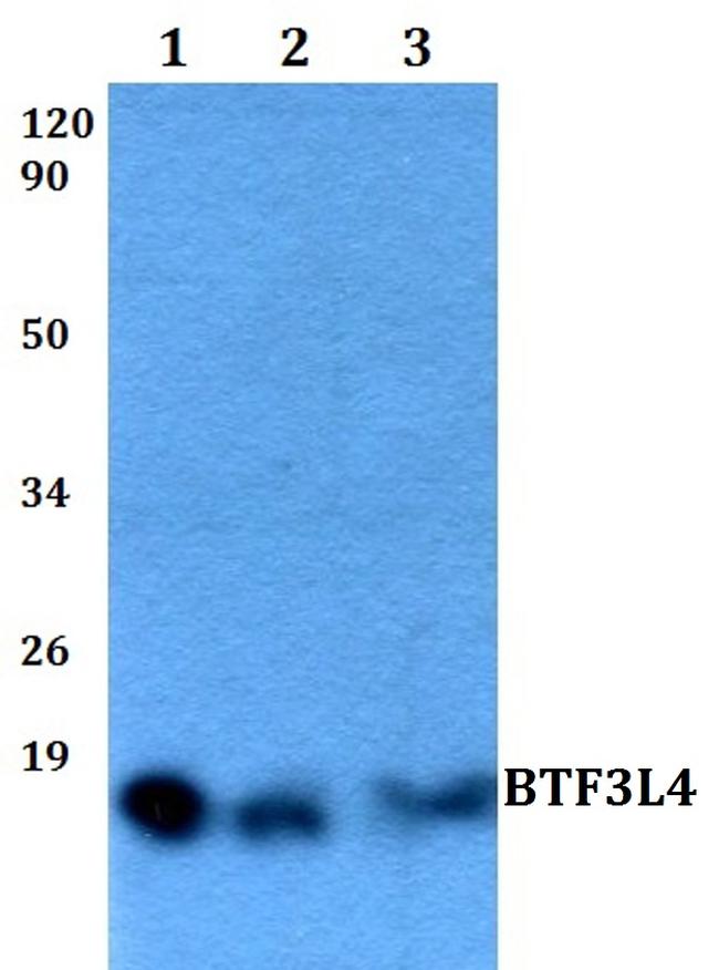 BTF3L4 Antibody in Western Blot (WB)