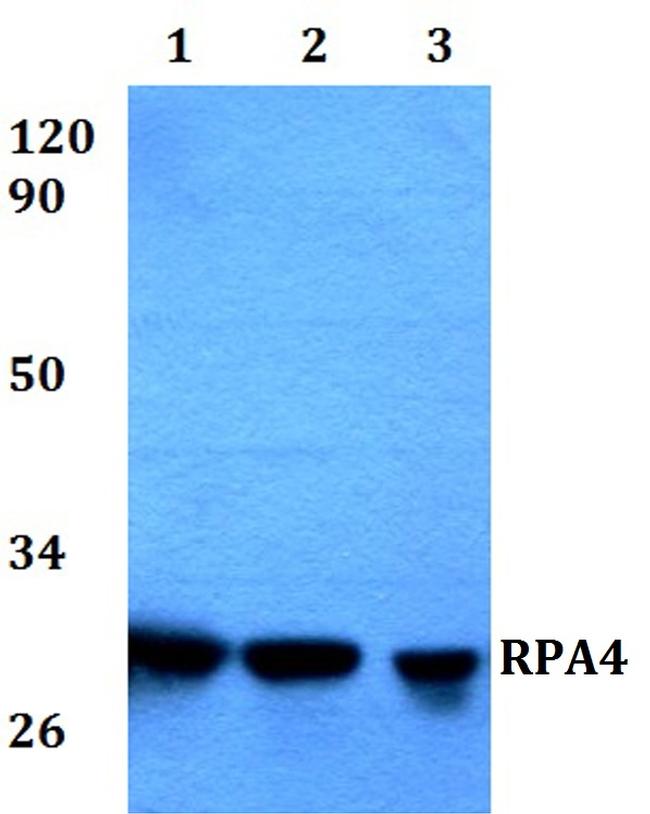 RPA4 Antibody in Western Blot (WB)