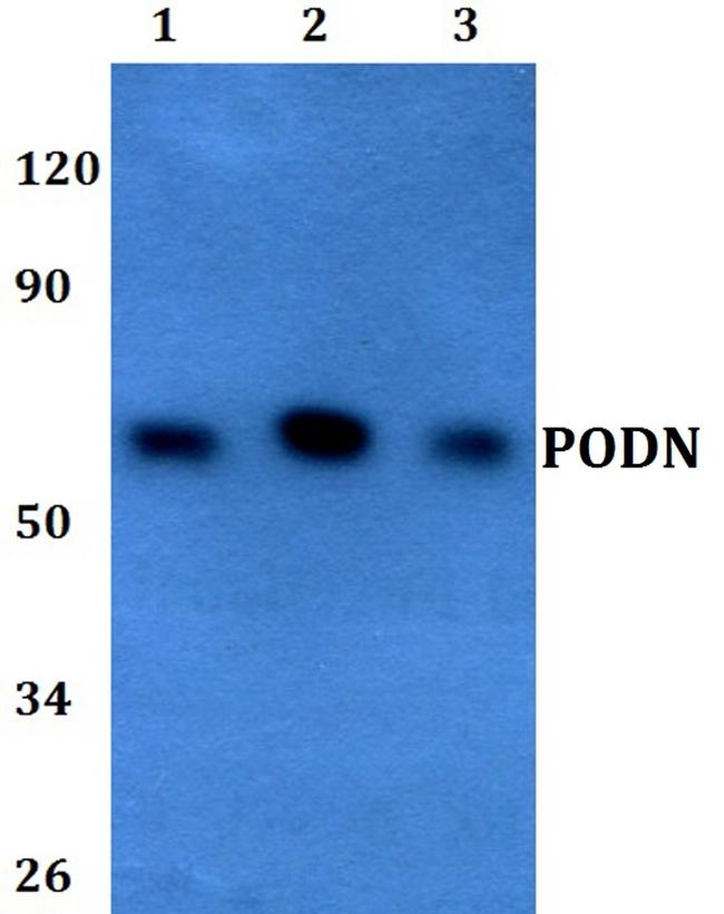 PODN Antibody in Western Blot (WB)