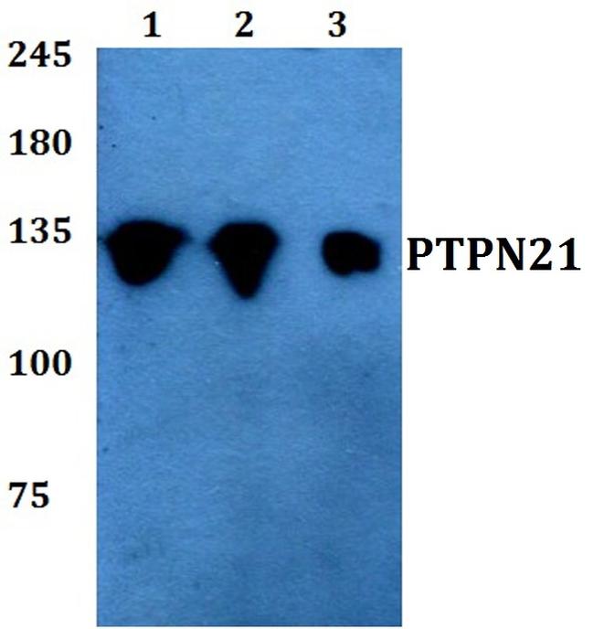 PTPN21 Antibody in Western Blot (WB)
