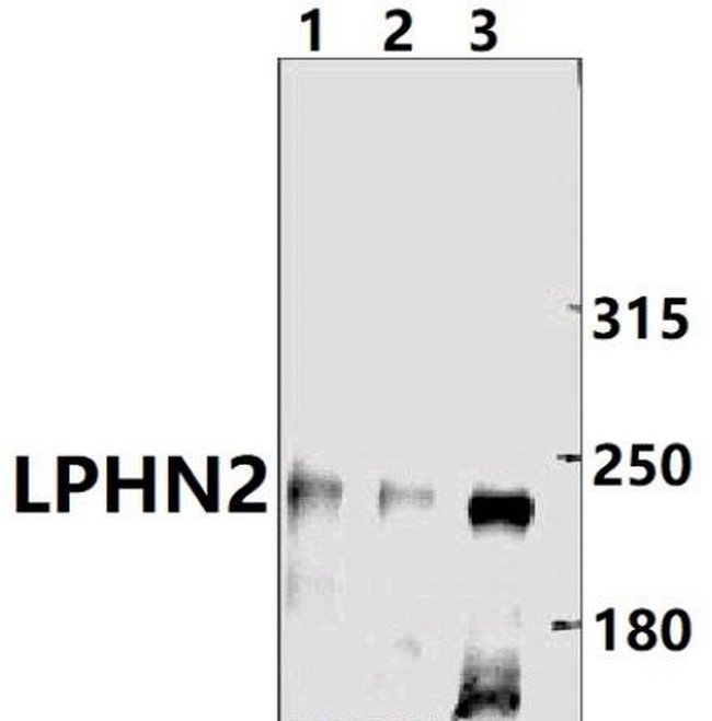 LPHN2 Antibody in Western Blot (WB)
