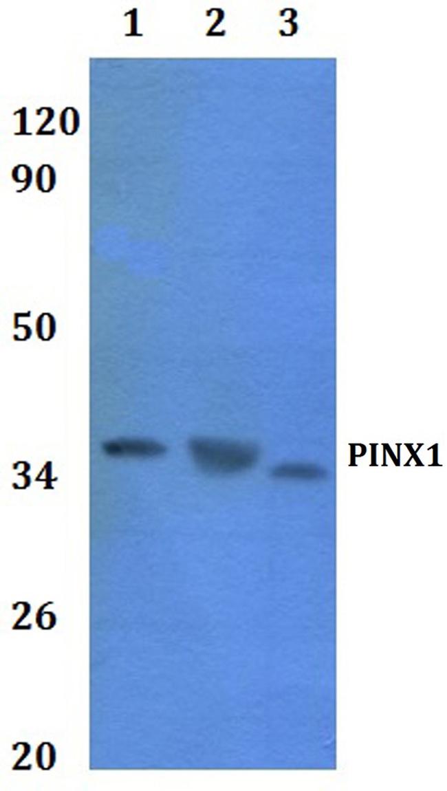 PINX1 Antibody in Western Blot (WB)