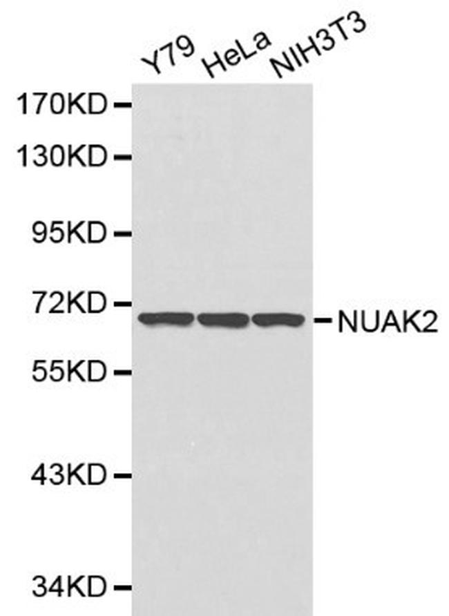 NUAK2 Antibody in Western Blot (WB)