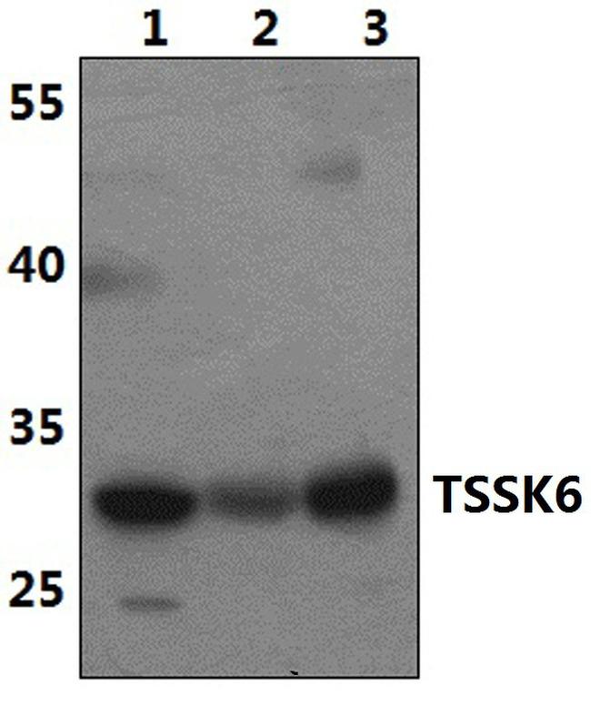 TSSK6 Antibody in Western Blot (WB)