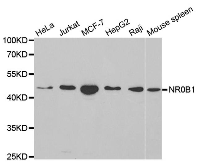 NR0B1 Antibody in Western Blot (WB)