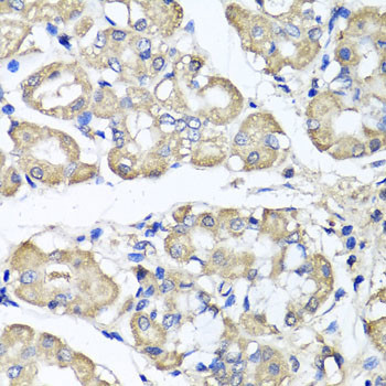 BCS1L Antibody in Immunohistochemistry (Paraffin) (IHC (P))