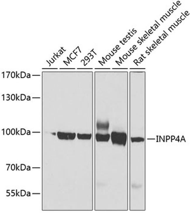 INPP4A Antibody in Western Blot (WB)