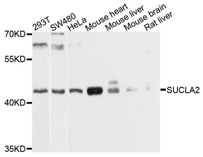 SUCLA2 Antibody in Western Blot (WB)