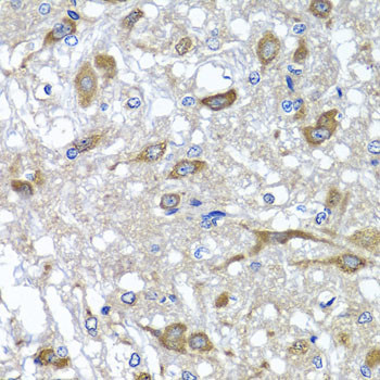 OSGEPL1 Antibody in Immunohistochemistry (Paraffin) (IHC (P))
