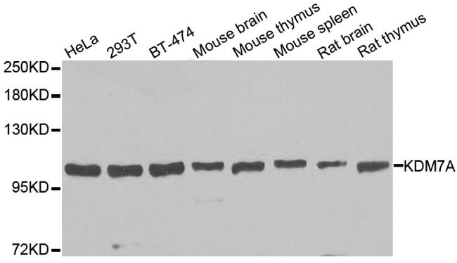 JHDM1D Antibody in Western Blot (WB)