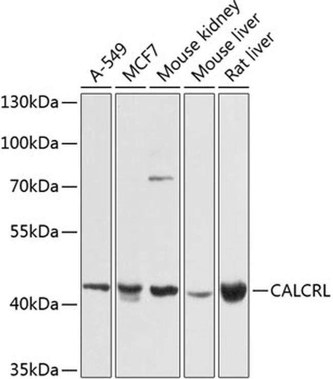 CALCRL Antibody in Western Blot (WB)