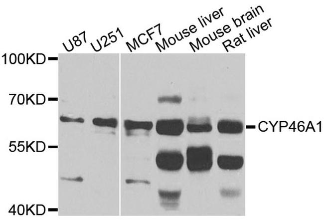 CYP46A1 Antibody in Western Blot (WB)