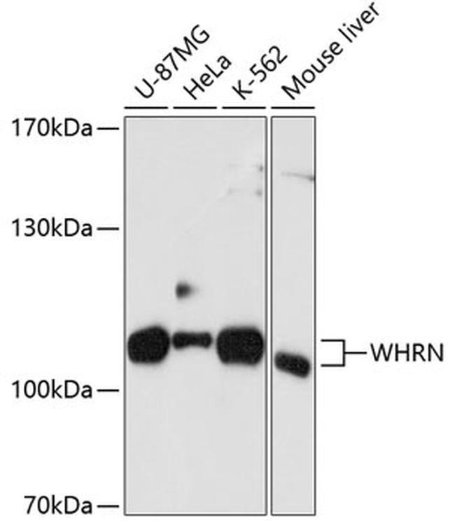 DFNB31 Antibody in Western Blot (WB)