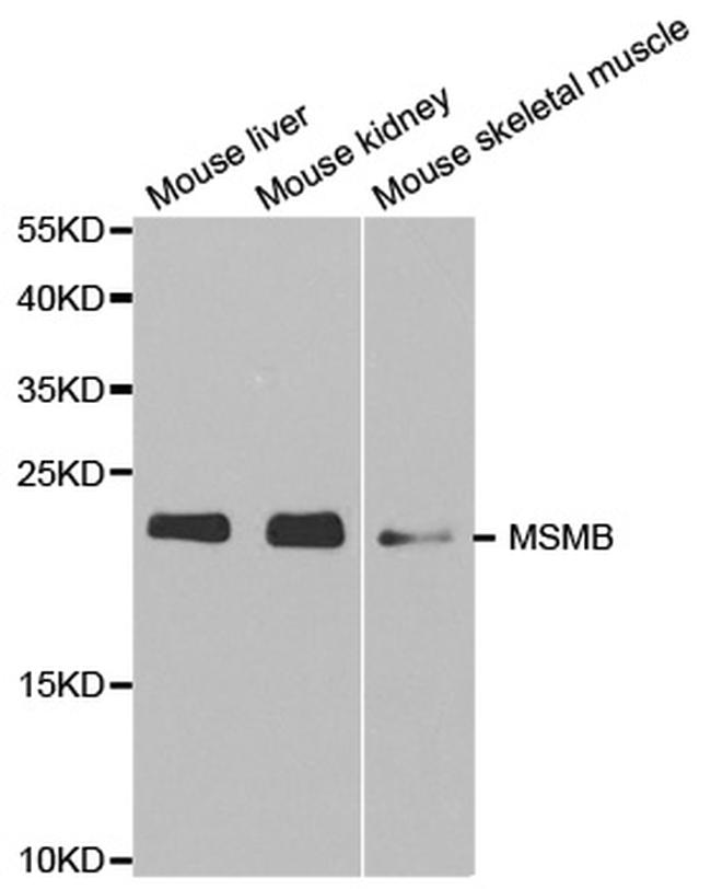 MSMB Antibody in Western Blot (WB)