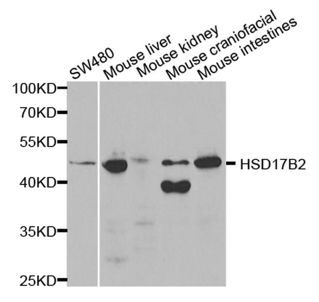 HSD17B2 Antibody in Western Blot (WB)