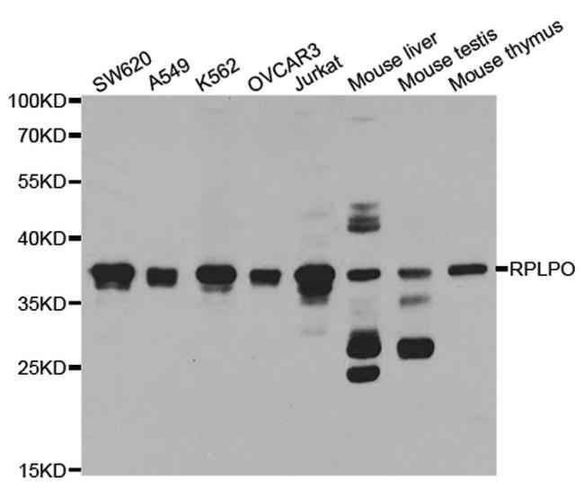 RPLP0 Antibody in Western Blot (WB)