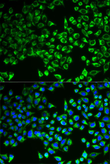 Citrate Synthase Antibody in Immunocytochemistry (ICC/IF)