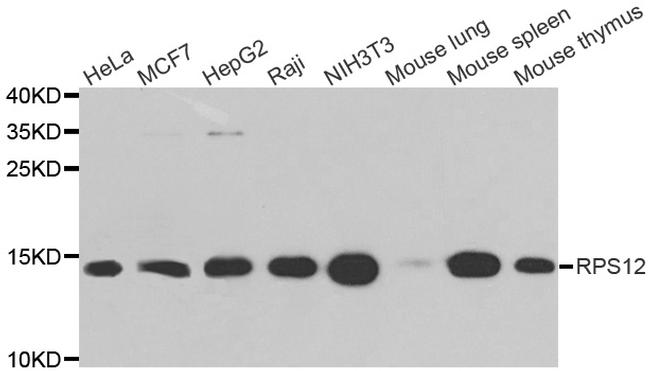 RPS12 Antibody in Western Blot (WB)